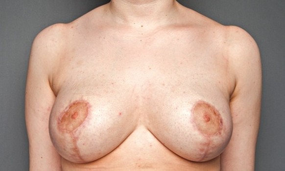 100 Brust-Bilder, 100 Frauen-Geschichten und die ungeschmink
