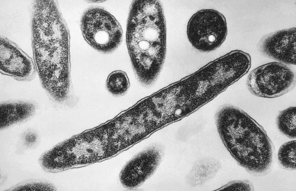 FILE - This 1978 electron microscope image made available by the Centers for Disease Control and Prevention shows Legionella pneumophila bacteria which are responsible for causing the pneumonic diseas ...