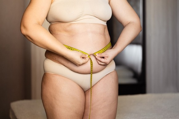 Well over a billion people are overweight;  this number is rising rapidly