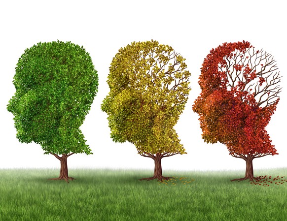 alzheimer demenz