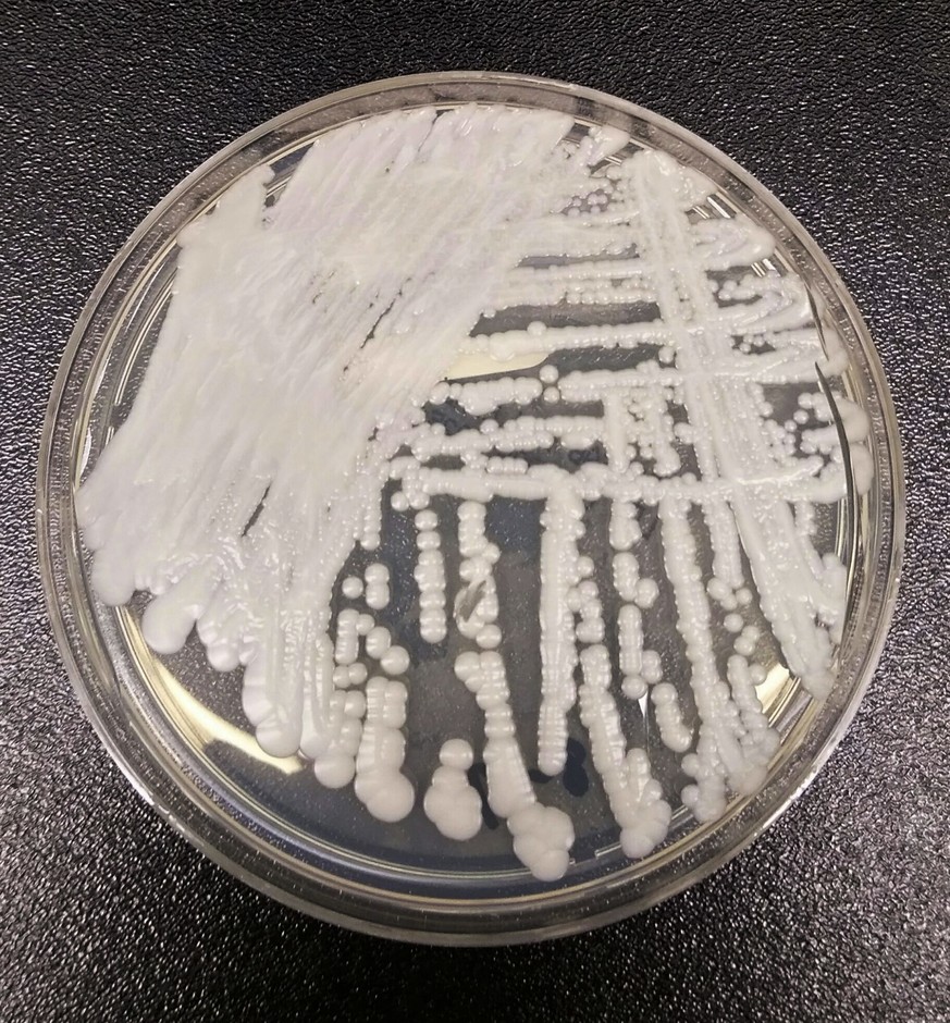 This undated photo made available by the Centers for Disease Control and Prevention shows a strain of Candida auris cultured in a petri dish at a CDC laboratory. On Tuesday, April 25, 2017, New York s ...