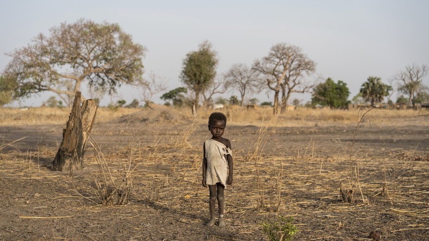 In this photo taken on Friday, March 10, 2017, a boy named Giel wears a small white bracelet around his ankle, signifying that he has just finished treatment in an outpatient therapeutic program, as he stands...