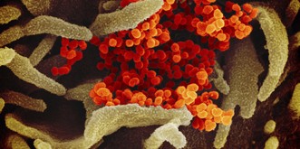 Was du zum Coronavirus wissen musst – die wichtigsten Punkte