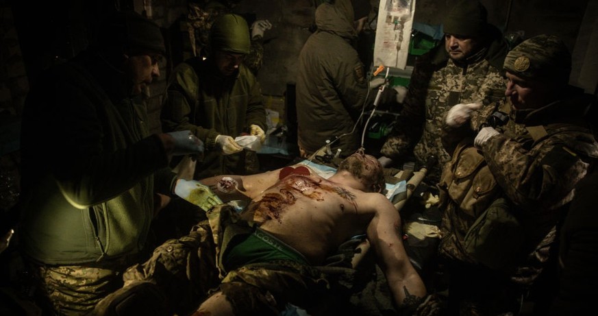 BAKHMUT, UKRAINE - DECEMBER 05: (EDITORS NOTE: Image contains graphic content) Military medics work on a member of the Ukrainian military with shrapnel wounds and burns to his entire body at a frontli ...