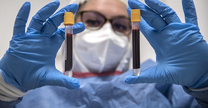 epa08341316 Health personnel from the House Laboratory carry out blood tests to identify possible cases of positivity to COVID-19, in Genoa, Italy, 03 April 2020. Countries around the world are increa ...