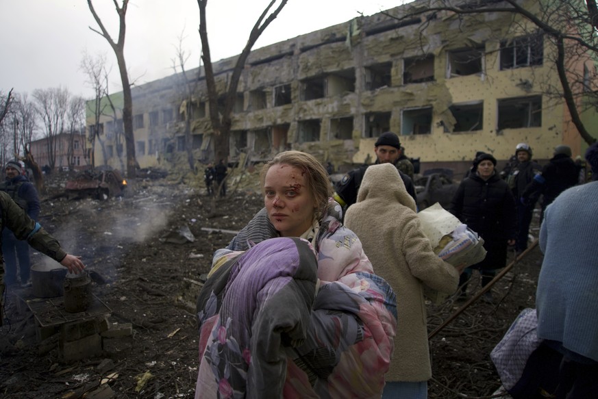 Marianna Vishegirskaya stands outside a maternity hospital that was damaged by shelling in Mariupol, Ukraine, Wednesday, March 9, 2022. Vishegirskaya survived the shelling and later gave birth to a gi ...
