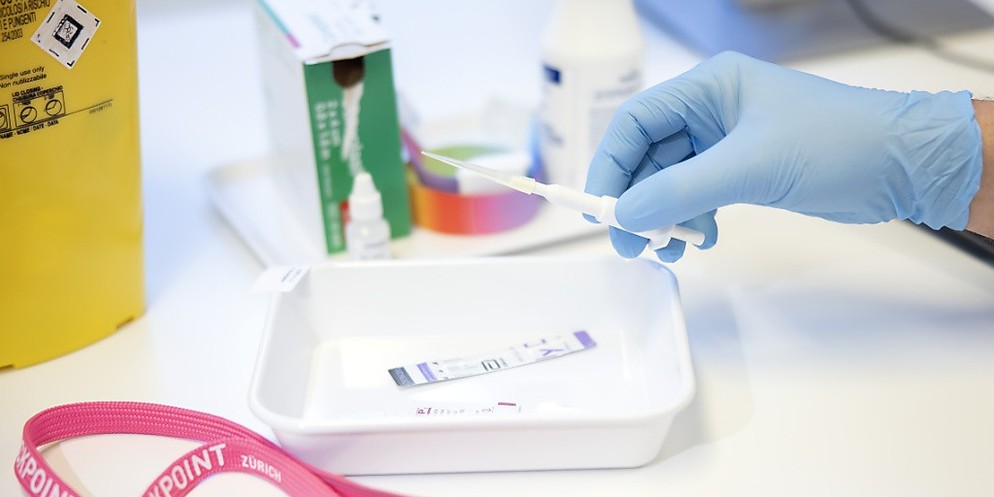 Menschen mit wechselnden Sexualpartnern sollten sich gemäss Aids-Hilfe Schweiz einmal im Jahr auf Geschlechtskrankheiten testen lassen. (Symbolbild)