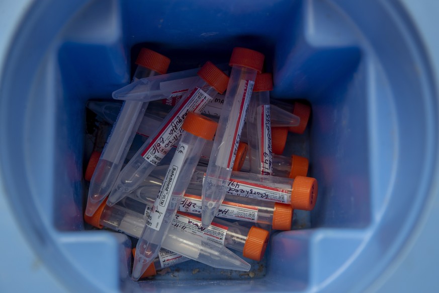 Nasal swab samples collected from suspected COVID -19 patients are seen inside a container before conducting COVID-19 RT-PCR Test in Srinagar, Indian-controlled Kashmir, Wednesday, Nov. 11, 2020. Indi ...