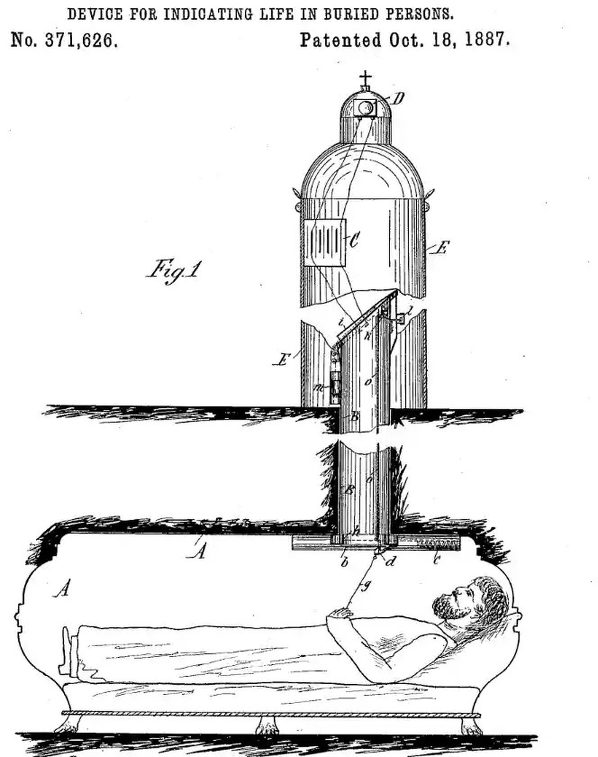Dieser Entwurf aus dem Jahr 1887 für einen Sicherheitssarg mit einem Atemluftrohr stammt von Gael Bedl.