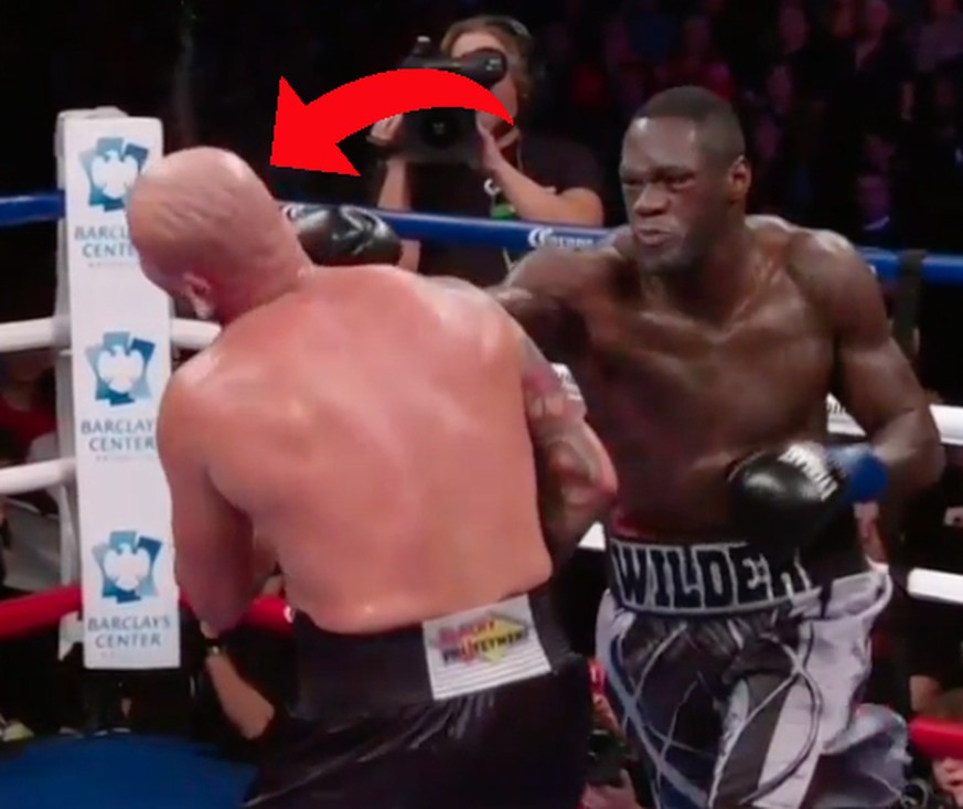 Fundstück des Tages: Hier siehst du, warum Boxen schlecht fürs Gehirn ist