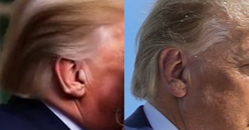 Donald Trumps Ohren, Fake vs. echt