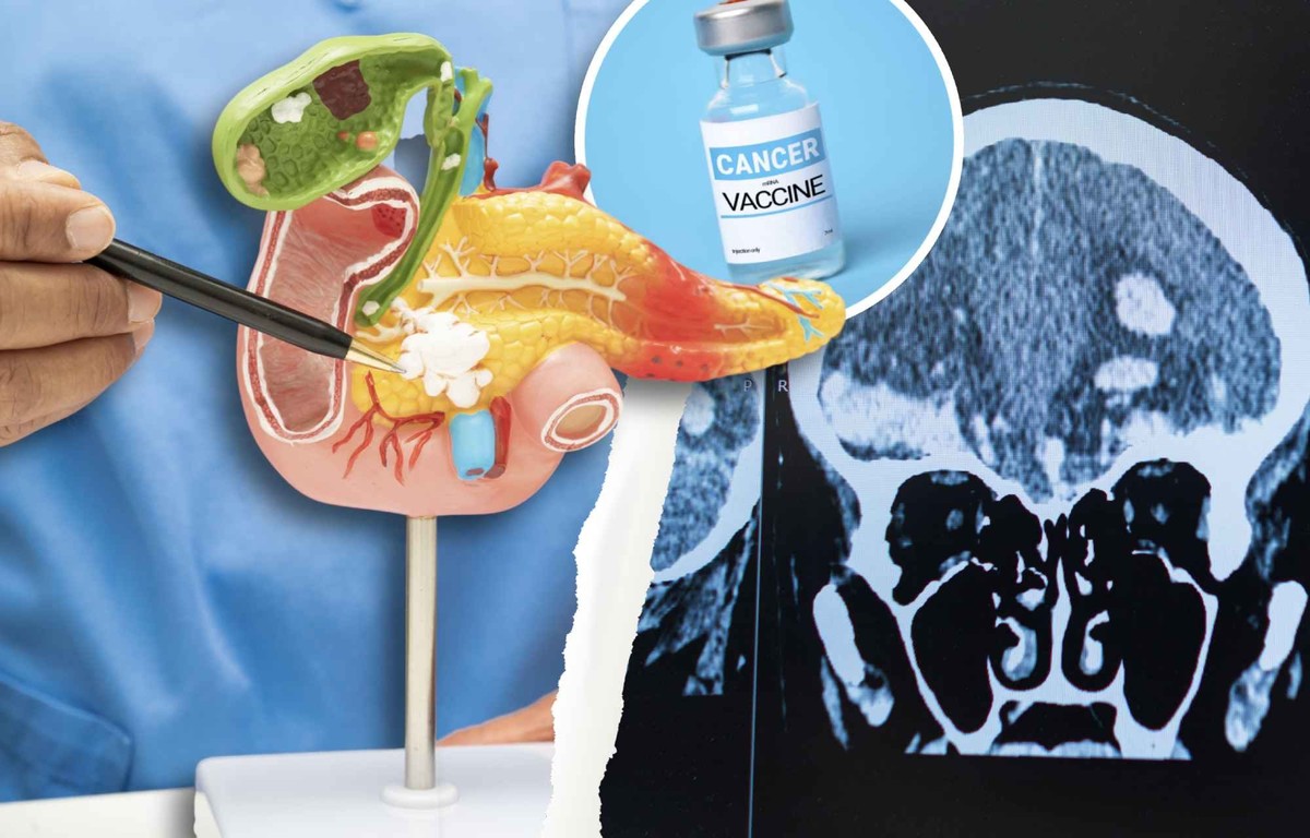 Voici comment l'IA impacte la médecine et la recherche sur le cancer.