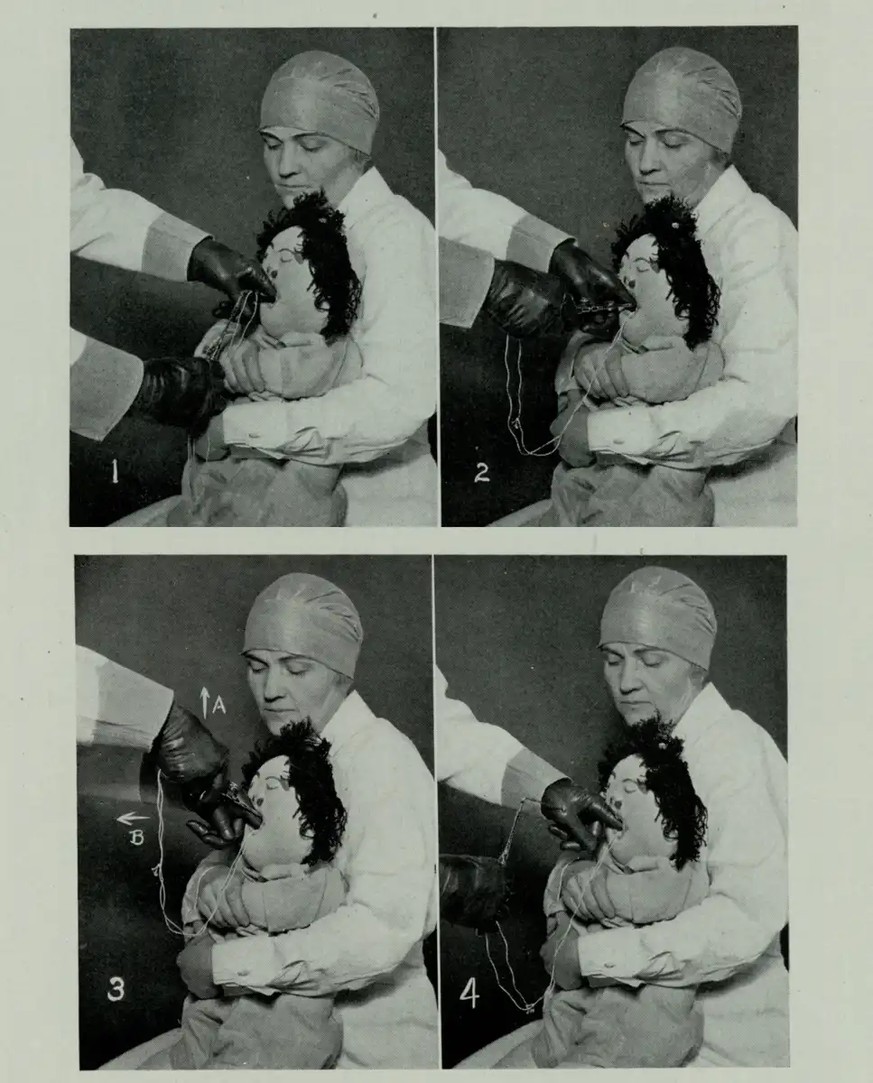 A picture of Chevalier Jackson “operating” on Michelle the Choking Doll
Chevalier Jackson demonstrating Michelle the Choking Doll Historical Medical Library