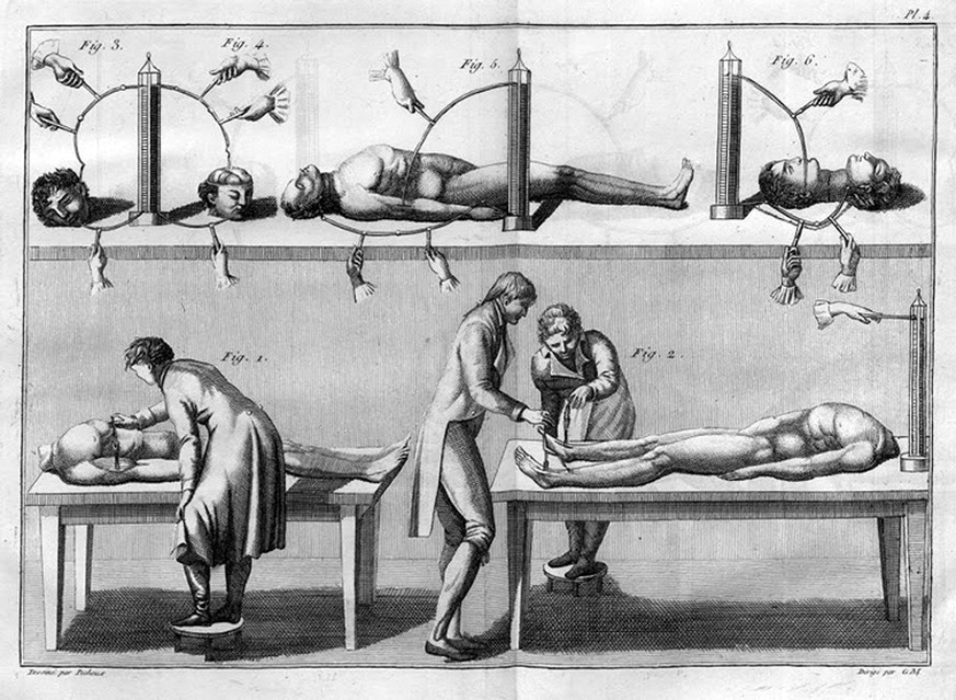 Giovanni Aldini experimentiert an der Leiche eines hingerichteten englischen Doppelmörders, 1804.