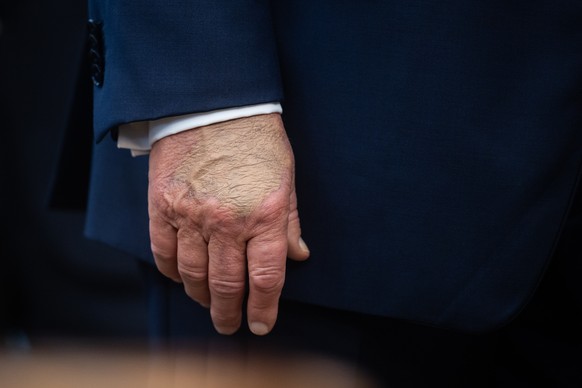 epa12417631 The right hand of US President Donald Trump is seen as he announces a drug-pricing deal with Pfizer in the Oval Office at the White House in Washington, DC, USA, 30 September 2025. EPA/FRA ...