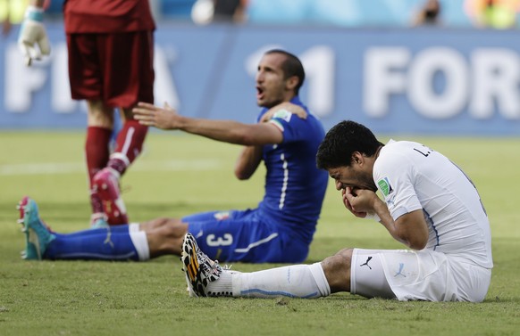 Italy's Giorgio Chiellini complains after Uruguay's Luis Suarez ran into his shoulder with his teeth during the group D World Cup soccer match between Italy and Uruguay at the Arena das Duna ...