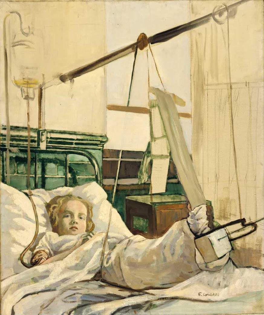 Die Penicillin-Behandlung eines Mädchens, gemalt von Ethel Gabain, 1944.