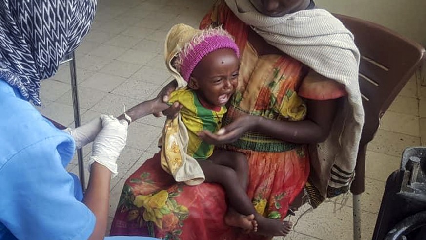 Medhin Gereziher, 1, is treated for malnutrition at the Ayder Referral Hospital in Mekele, in the Tigray region of northern Ethiopia Tuesday, Oct. 4, 2022. Babies are dying in their first month of lif ...