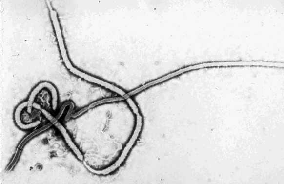 Das Ebolavirus in einer Mikroskop-Aufnahme.