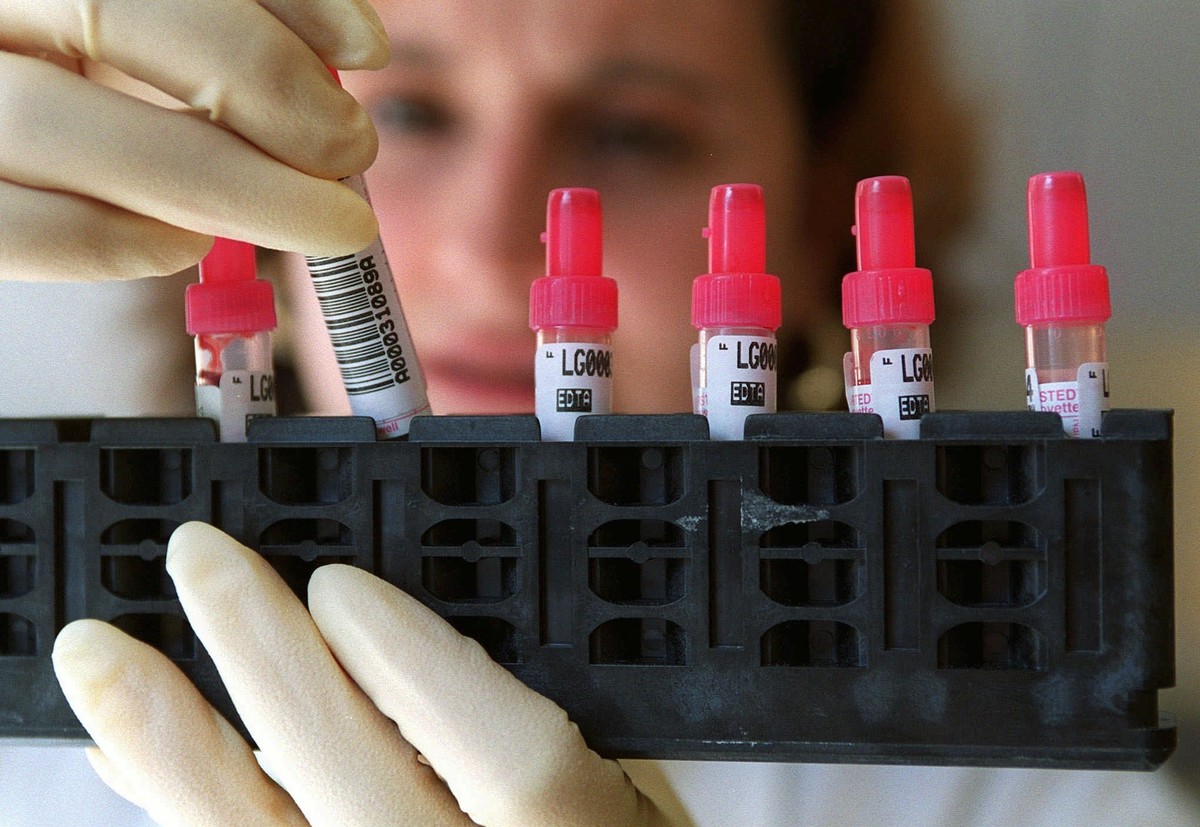 ARCHIVBILD ZUR DIAGNOSEMELDUNG DES BAG ZU DEN NEUEN HIV-INFEKTIONEN 2017, AM MONTAG, 19. NOVEMBER 2018 - Une laborantine controle des echantillons de sang avant leur analyse, ce mardi 21 mars 2000 dan ...