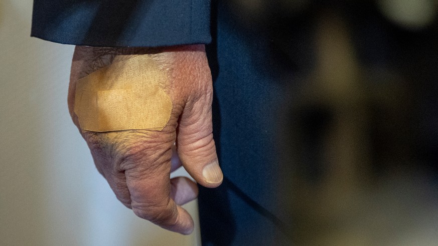The right hand of President Donald Trump has a bandage on it as he speaks with reporters while in flight on Air Force One from his Mar-a-Lago estate in Palm Beach, Fla., to Joint Base Andrews, Sunday, ...