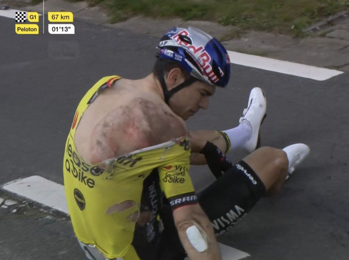 Le Belge a subi plusieurs fractures mercredi.