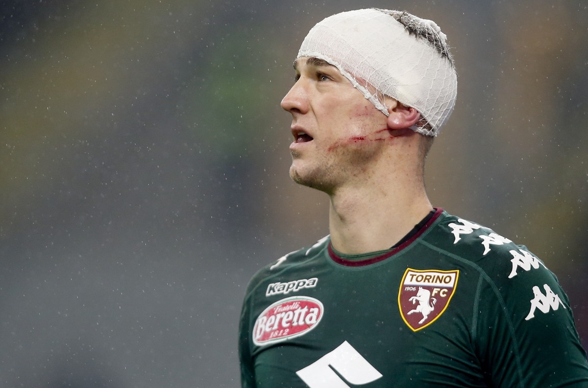 Torino goalkeeper Joe Hart wears a bandage after clashing with AC Milan's Gianluca Lapadula during an Italian Cup, Round of 16 soccer match, at the San Siro stadium in Milan, Italy, Thursday, Jan ...