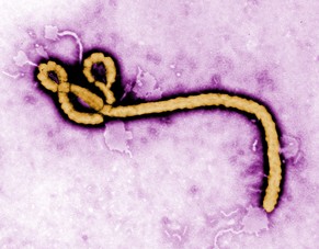So sieht das Virus aus.