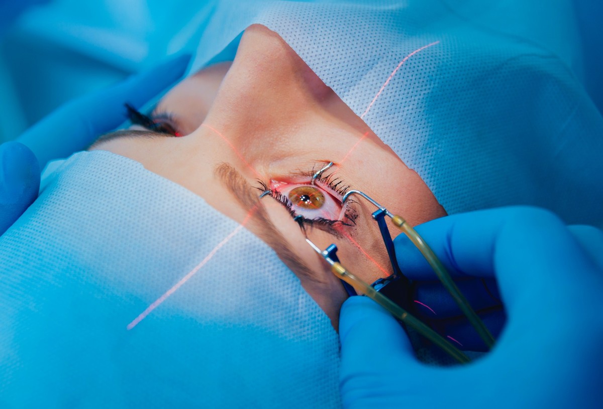 Augenoperation