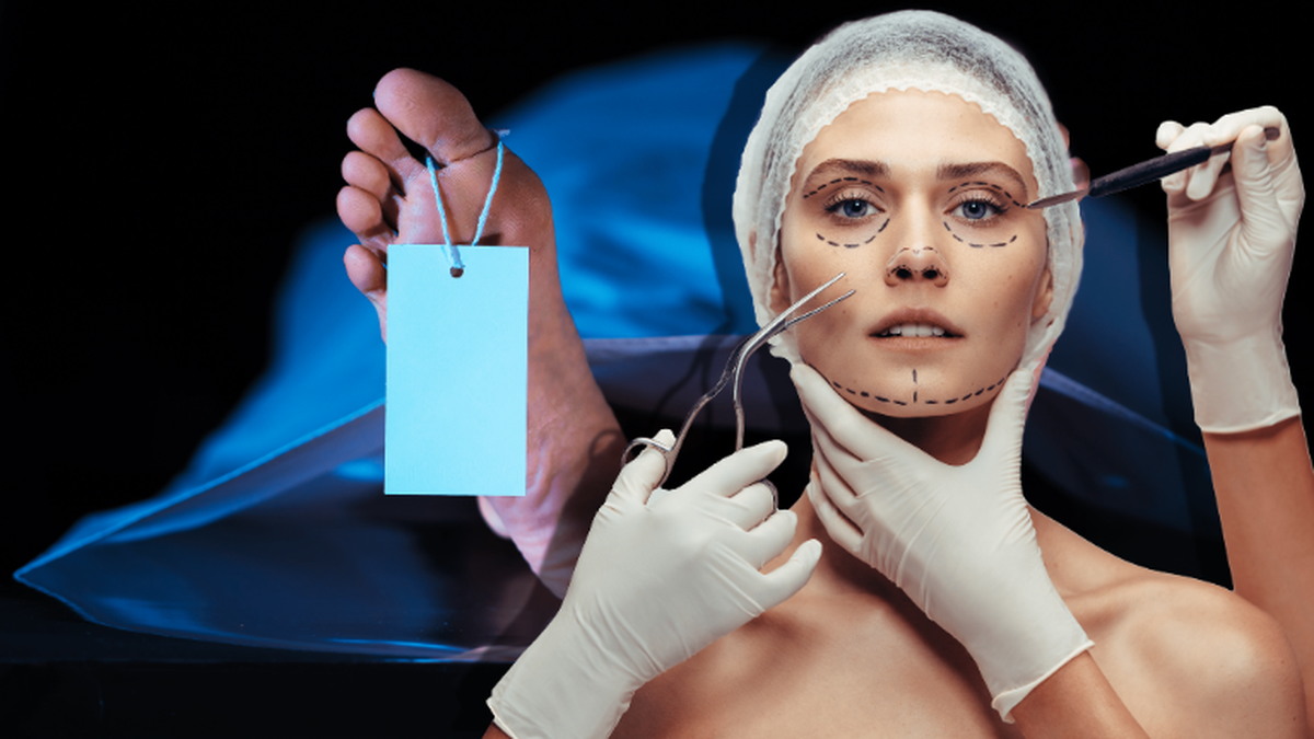 Nouvelle tendance de chirurgie aux Etats-Unis: ils se font injecter de la graisse de cadavres.