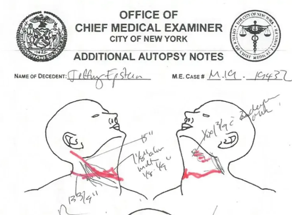 Veröffentlicht in den Epstein-Akten: Notizen nach der Autopsie zu Halsverletzungen.