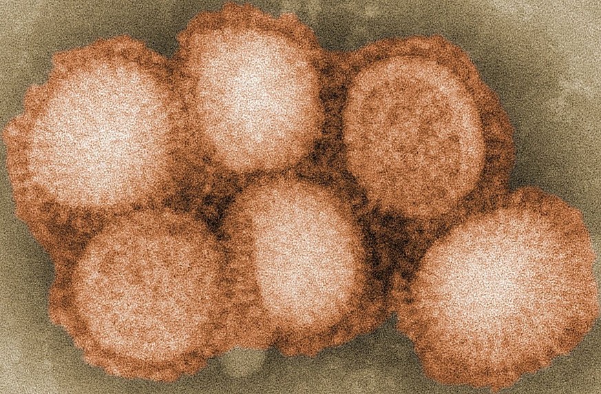 Dies ist das Influenzavirus A/H1N1. Die saisonale Grippe ist keine harmlose Krankheit, aber weniger gravierend als Covid-19.  
