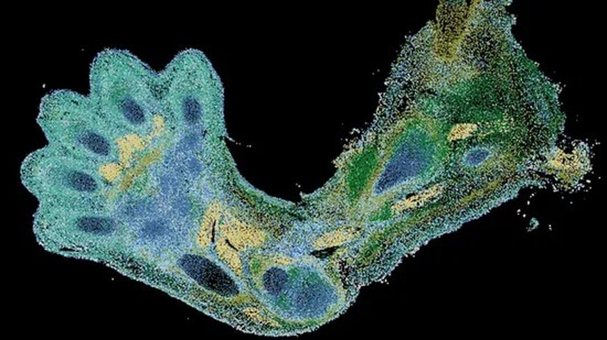 Arm eines Embryos Embryo