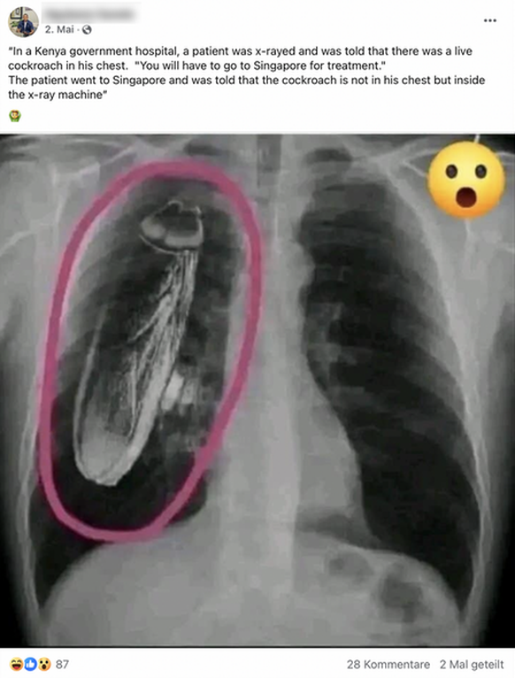 Das Röntgenbild mit der riesigen Kakerlake ist ein Fake.
