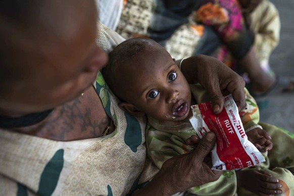 Letmedhin Eyasu holds her one year-old son Zewila Gebru, who is suffering from malnutrition at a health center in Agbe, Ethiopia Monday, June 7, 2021. For months, the United Nations has warned of fami ...