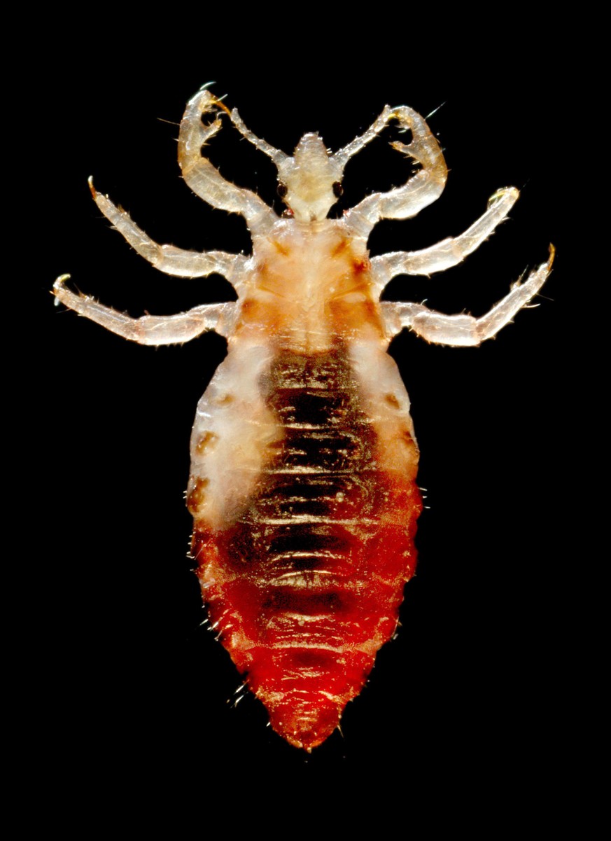 Körperlaus
https://upload.wikimedia.org/wikipedia/commons/9/92/Body_lice.jpg