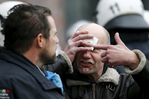 Platzwunde: Ein «Hogesa»-Teilnehmer nach einer Attacke von Gegendemonstranten.