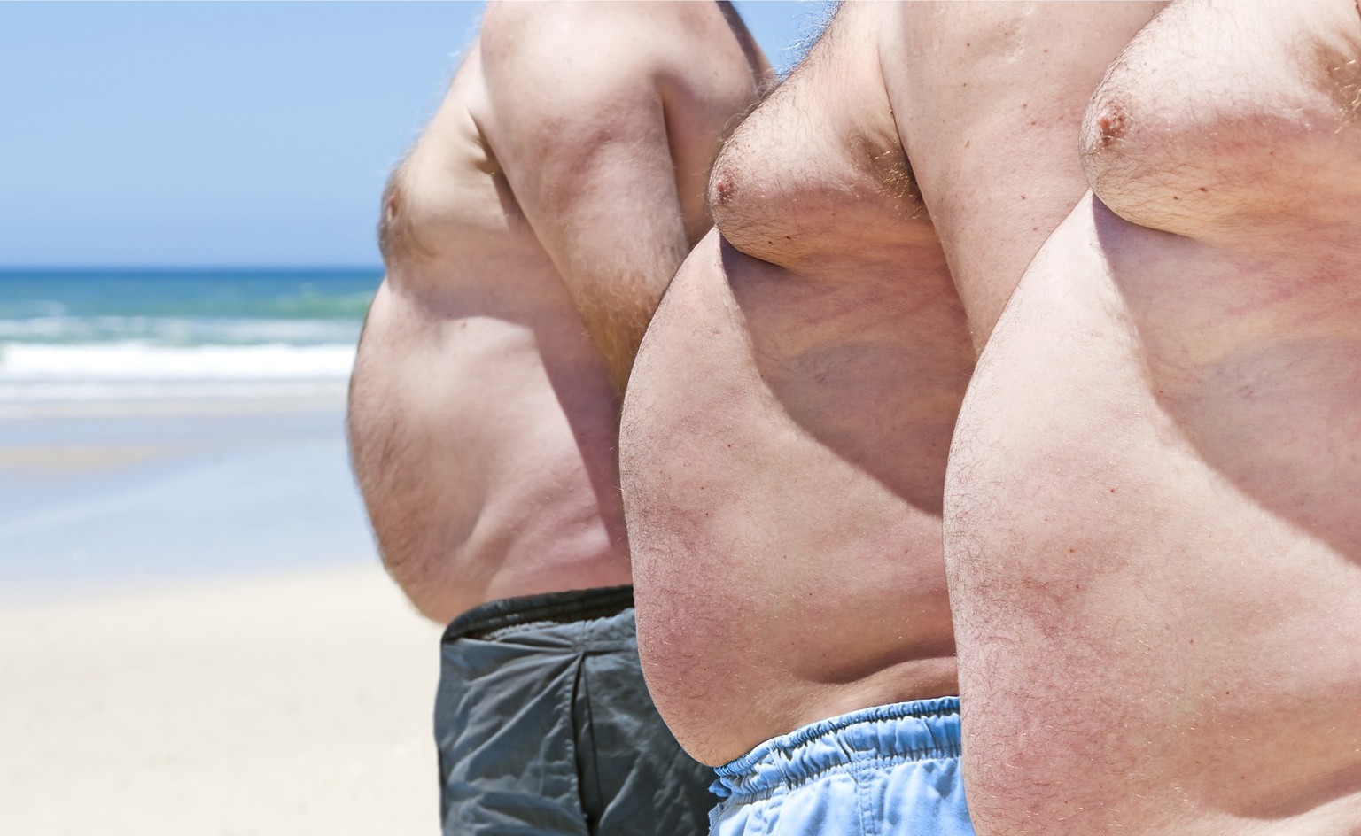 Dicke Männer-Bäuche am Strand. Übergewicht (Adipositas) wird fast überall auf der Welt zu einem immer grösseren Problem.