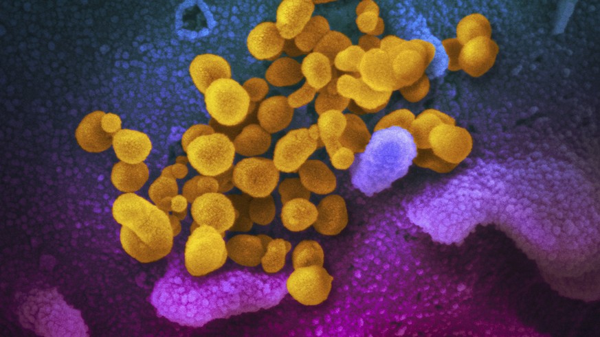 Virus Corona: 5300 laporan efek samping setelah vaksinasi terhadap Covid
