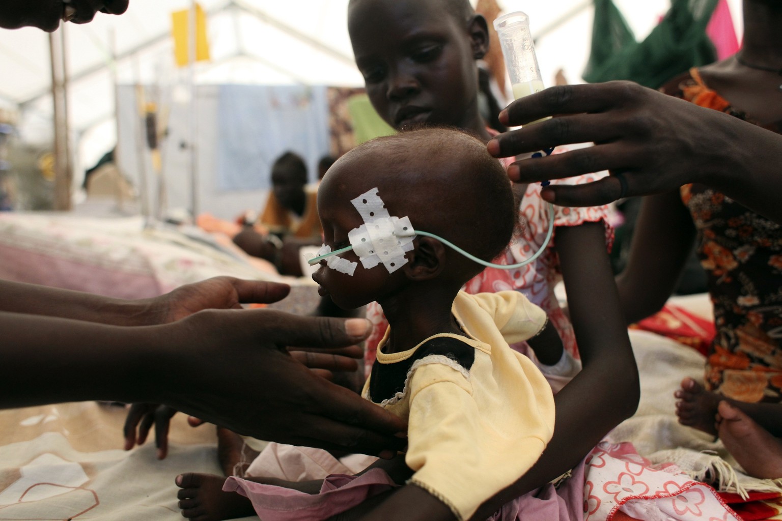 Ein unterernährtes Kind wird in einem Spital der&nbsp;«Medecins Sans Frontières» in Malakal im Südsudan behandelt.
