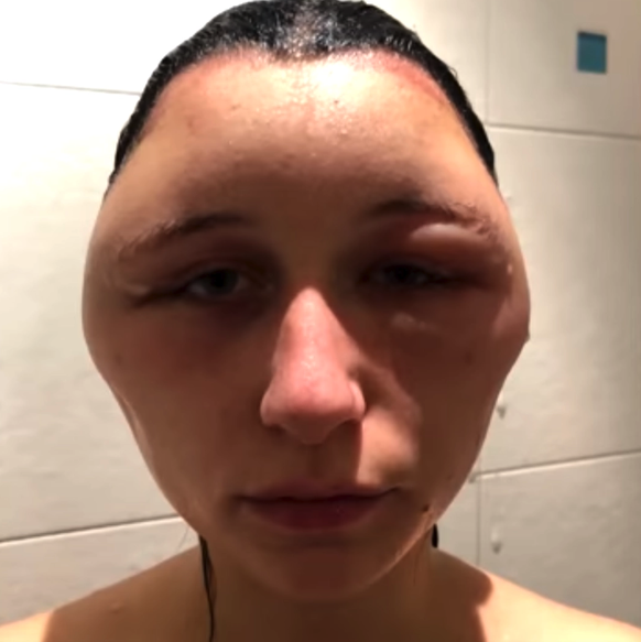Das ist Estelle, 19, eine Studentin aus Vitry-sur-Seine, Frankreich. 
Haare färben fail