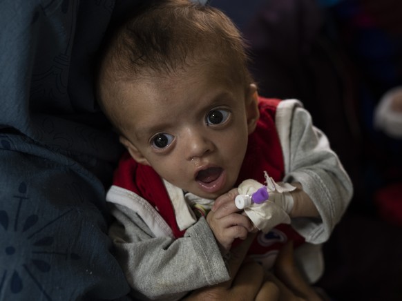 A mother holds her baby as he undergoes treatment at the malnutrition ward of the Ataturk National Children&#039;s Hospital in Kabul, Afghanistan, Thursday, Dec, 2, 2021. According to U.N. figures fro ...