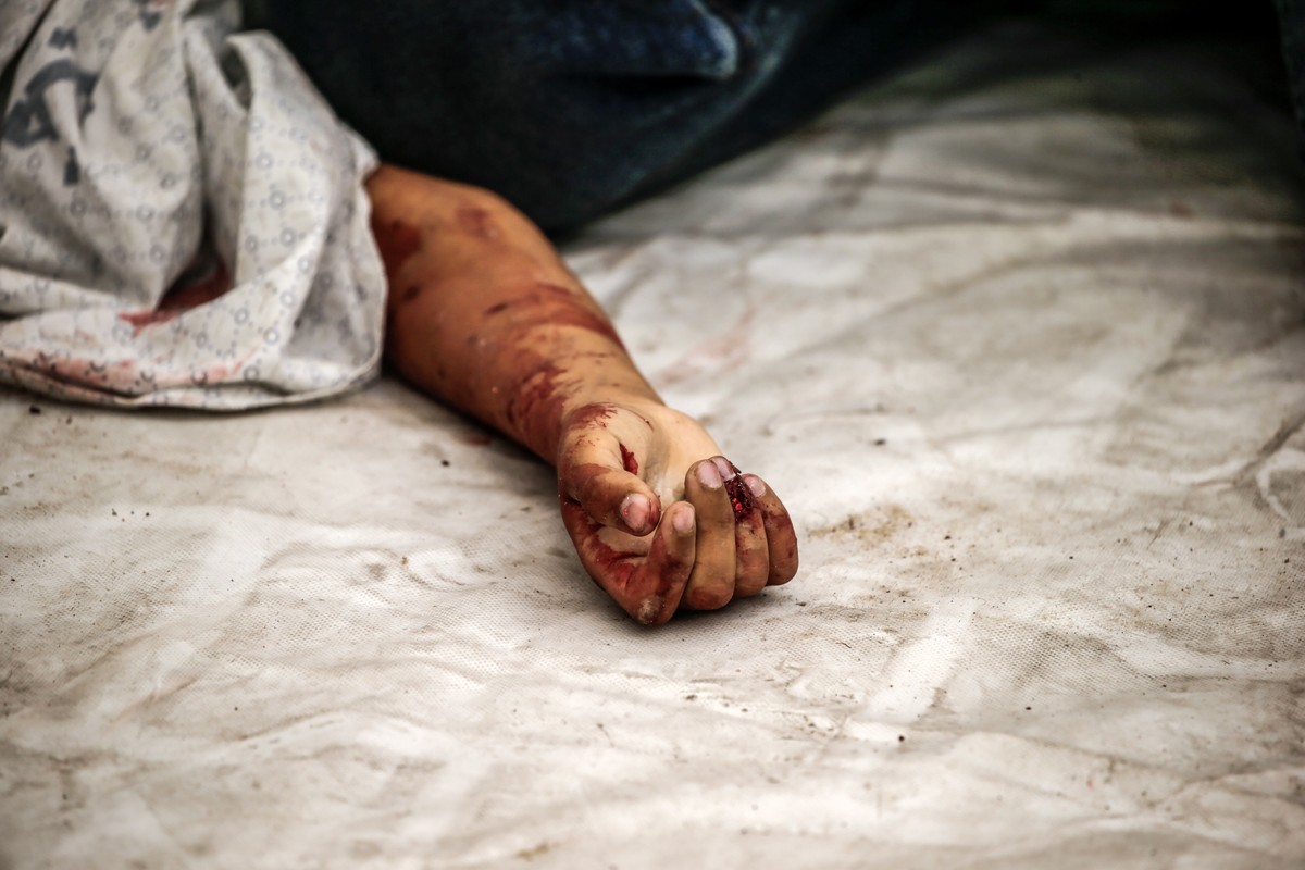 epa10909193 The body of a Palestinian child lies at the Al-Shifa hospital after an Israeli air strike in Gaza City, 09 October 2023. The Israeli army announced on 09 October, it carried out over 500 s ...