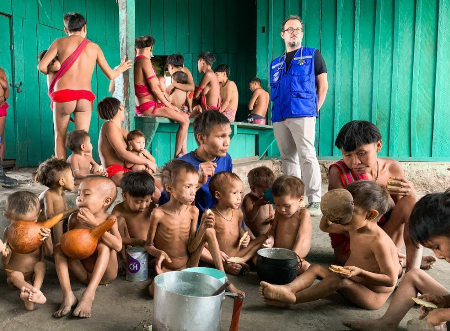 Brasilien Yanomami ausgehungerte Kinder im Regenwald