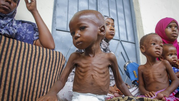 A malnourished two year-old sits by his mother, left, who was recently displaced by drought, at a malnutrition stabilization center run by Action against Hunger, in Mogadishu, Somalia Sunday, June 5,  ...