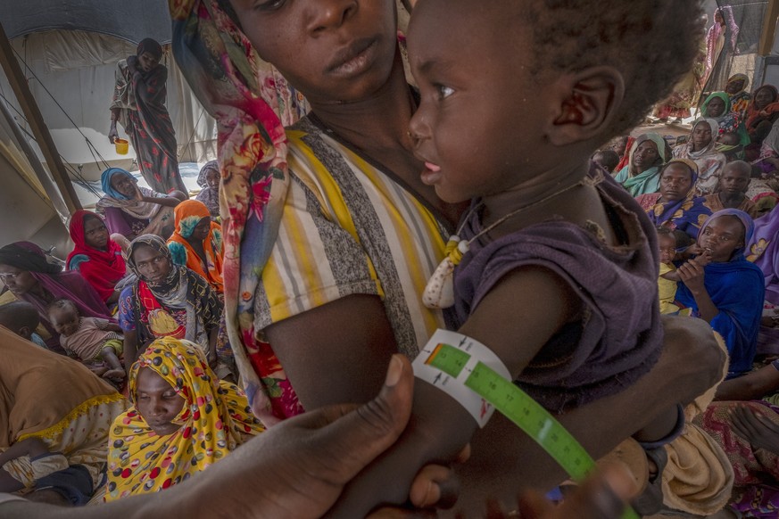 epa11264106 A Sudanese refugee child receives medical treatment in the Adre transition camp, on the border with Sudan in Adre, Chad, 05 April 2024 (issued 07 April 2024). Since the war in Sudan began, ...