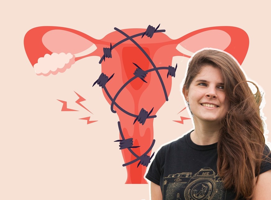 «Zwischenmenschlich hat mir die Krankheit ebenfalls zugesetzt» – Flawia Visetti hat Endometriose.