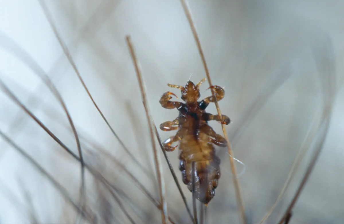Die Kopflaus (Pediculus humanus capitis) zwischen Menschenhaar.