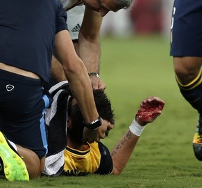 Mandzukic verletzt sich im Spiel gegen Piräus an der Nase.