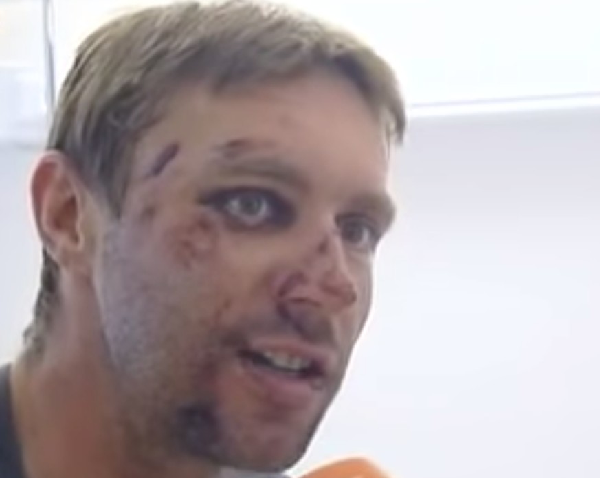 21.07.2009: Jens Voigt stürzt fürchterlich und gibt drei Tage später ein obercooles Interview